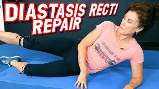 Top 5 Exercises to REPAIR Diastasis Recti [upl. by Leopold]