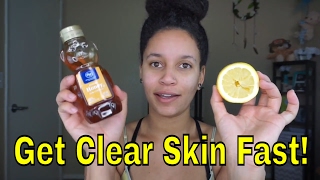 DIY Face Mask  Clear Skin With Honey amp Lemon [upl. by Ahsiemak]