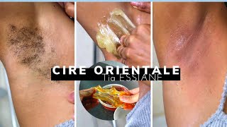 Epilation avec des cires orientales achetées sur le net Résultat IMPRESSIONNANT [upl. by Charlet581]