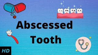 Abscessed tooth Causes SIgns and Symptoms Diagnosis and Treatment [upl. by Hunfredo]