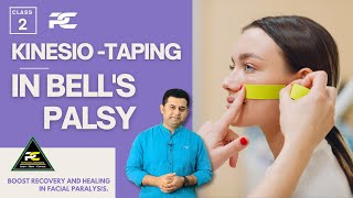 KINESIOTAPING TECHNIQUES FOR BELLS PALSY PATIENT  LEARN TAPING TO RECOVER FACIAL MOVEMENTS [upl. by Jilleen]