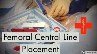 Femoral Central Line Placement [upl. by Gui953]