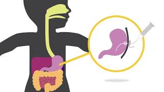 Proper Feeding Techniques for Babies [upl. by Fital]