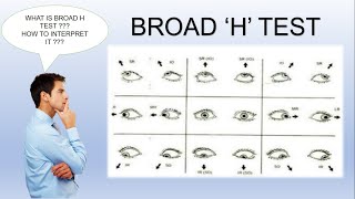 Broad H Test  Ocular Motility Test [upl. by Fari]