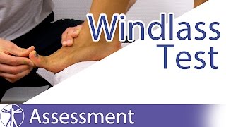 The Windlass Test  Plantar Fasciitis [upl. by Ahcarb]