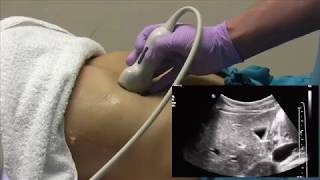 How I do it Ultrasound of the Abdomen [upl. by Busch]