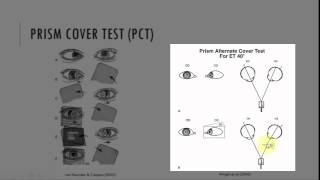 Prism Cover Test PCT [upl. by Inalaeham]