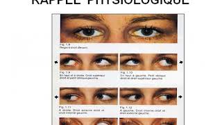 Troubles de la motilité oculaire Diplopie Strabisme [upl. by Graubert]