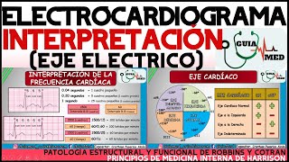 ELECTROCARDIOGRAMA INTERPRETACIÓN  GuiaMed [upl. by Handbook726]