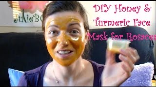 DIY Manuka Honey and Turmeric Face Mask for Rosacea and Redness  Rosy JulieBC [upl. by Nnaegroeg]