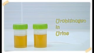 Urobilinogen in Urine [upl. by Euqininod]