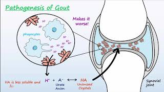 Gout  Mechanisms amp Treatment [upl. by Fein]