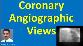 Coronary Angiographic Views [upl. by Woothen]