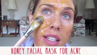 Homemade Honey Facial Mask For Acne  Cassandra Bankson [upl. by Stephana]