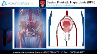 What is Plasmapheresis [upl. by Magner]