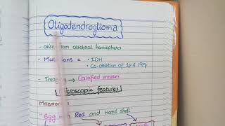 CNS Tumors  Robbins Pathology [upl. by Cordey]