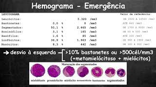 Avaliação rápida do hemograma [upl. by Lliw]