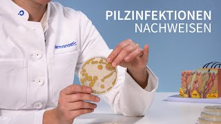 Hautpilz erkennen  So funktionert der Nachweis │Dr med Alice Martin [upl. by Tandy50]