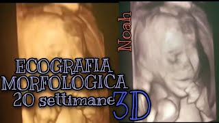 Video Ecografia MORFOLOGICA in 3D 20 settimane di gravidanza💙 Noah💙 [upl. by Ahsinav]