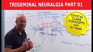 Trigeminal Neuralgia  Causes and Treatment  Part 1 [upl. by Ayotol]