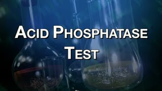 Acid Phosphatase Test [upl. by Idolem]