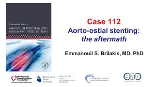 Case 112 PCI Manual  Aortoostial stent challenges [upl. by Kcirdnek]