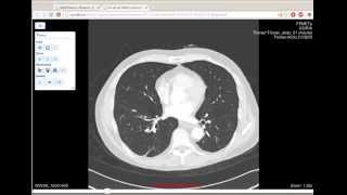 Orthanc Web Viewer Demo [upl. by Lebam]
