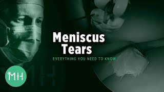 Physical Therapy Meniscus Tear Exercises  How To Avoid Surgery [upl. by Fayre]