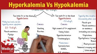 Hyperkalemia Vs Hypokalemia  EASY TO REMEMBER [upl. by Selby]