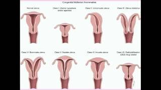 Urinary Tract Infections UTI Overview  Causes Risk Factors Symptoms Diagnosis Treatment [upl. by Nrobyalc]