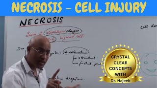 Necrosis  Cell Injury  General Pathology 🩺 [upl. by Anahsor]