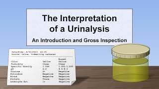 Interpretation of the Urinalysis Part 1  Introduction and Inspection [upl. by Apthorp]