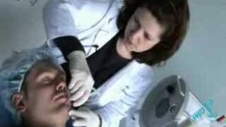 Microdermabrasion  Procedures [upl. by Htebarual523]