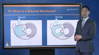 Meniscus Tears  Everything you need to know [upl. by Ecirahs728]