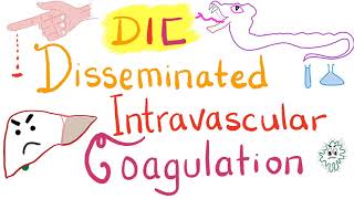 Disseminated Intravascular Coagulation DIC [upl. by Akihsay]