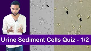 Urine Sediment Cell Identification Training Quiz  12 [upl. by Ostraw890]