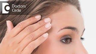 Is Povidone Iodine solution helpful in treating acne  Dr Sudheendra Udbalker [upl. by Uda754]