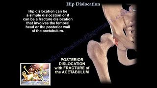 Destiny is minedouble shoulder disarticulation amputee [upl. by Anu424]